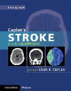 Caplan\'s Stroke