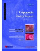 Colposcopia : tehnica si diagnostic
