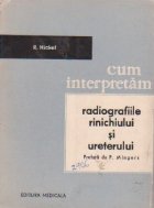 Cum interpretam radiografiile rinichiului si ureterului