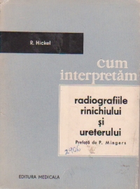 Cum interpretam radiografiile rinichiului si ureterului