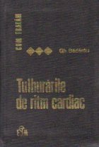 Cum tratam tulburarile de ritm cardiac