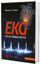 EKG - Tot ce trebuie să știi
