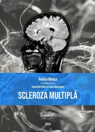 Scleroza multiplă