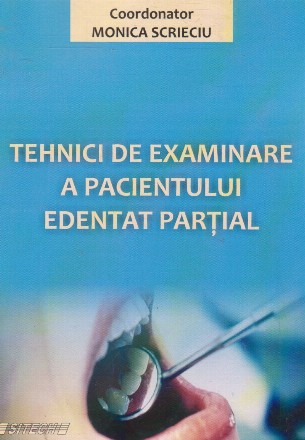 Tehnici de examinare a pacientului edentat partial