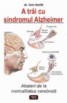 A trai cu sindromul Alzheimer