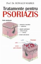 Tratamente pentru psoriazis