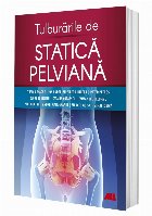 Tulburările statică pelviană